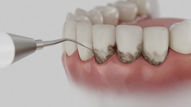 Trusted Dental Crowns And Bridges service in Murillo, TX - Dentist Open Now